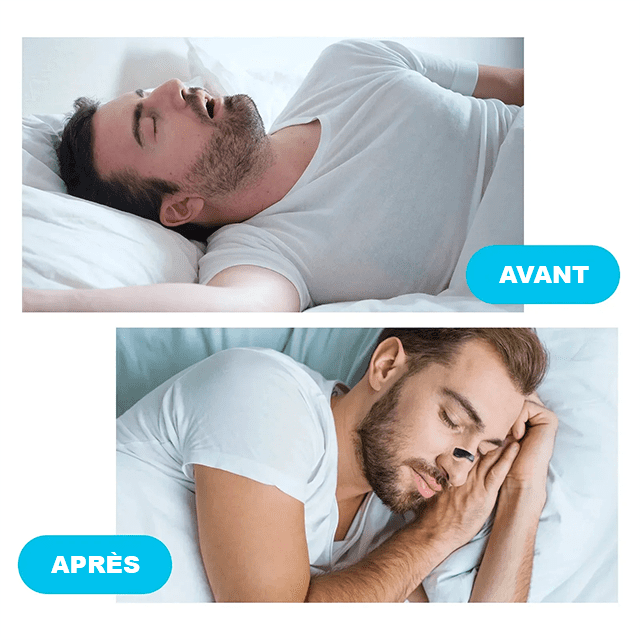 clip-nasal-anti-ronflement-avant-apres